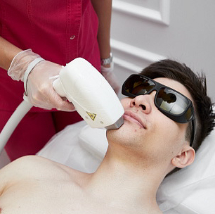 Эпиляция Мужчины Подбородок