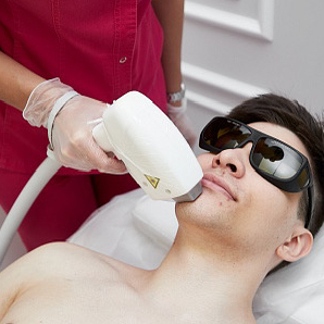 Эпиляция Мужчины Над губой (усы)