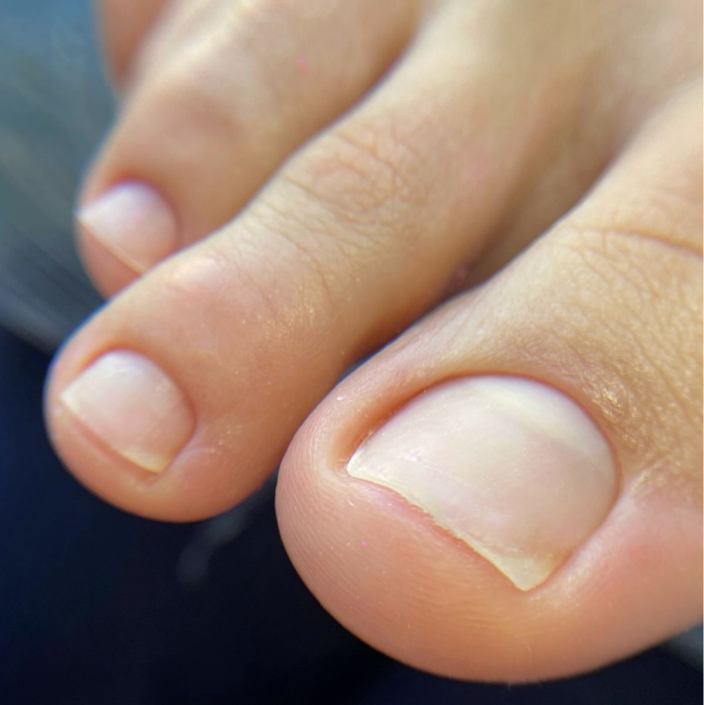 Педикюр ( пальцы)