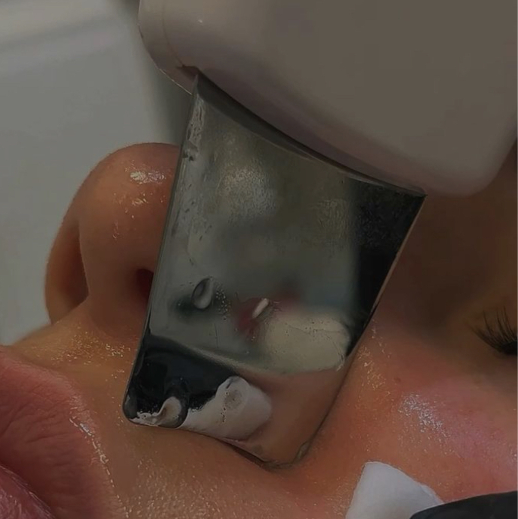 Ультразвуковая чистка