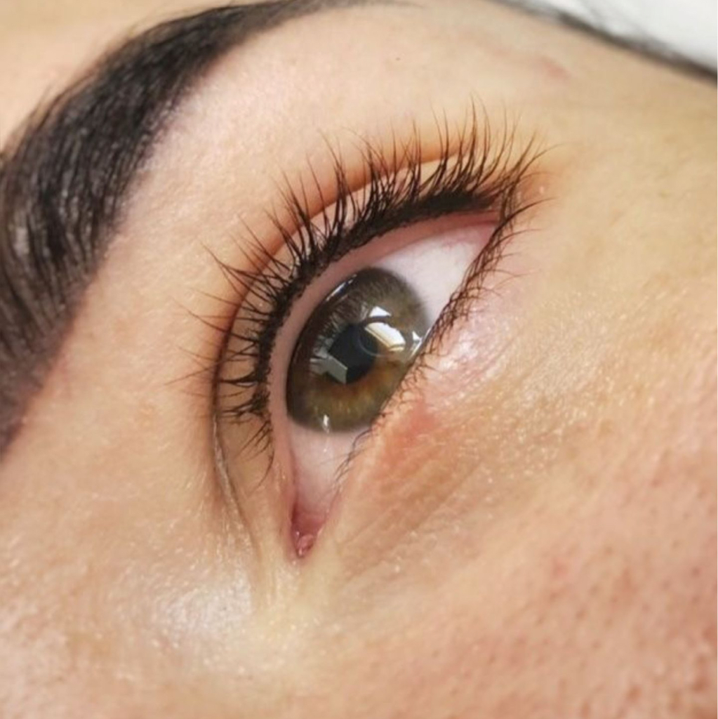 Перманент межреснички