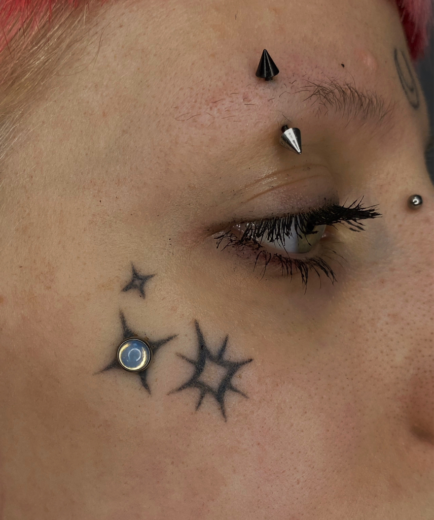 Установка микродермала