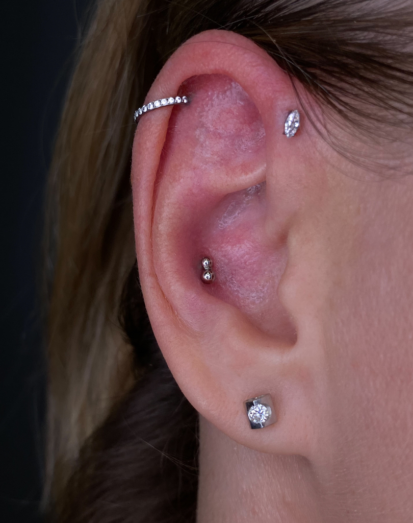 Форвард хеликс