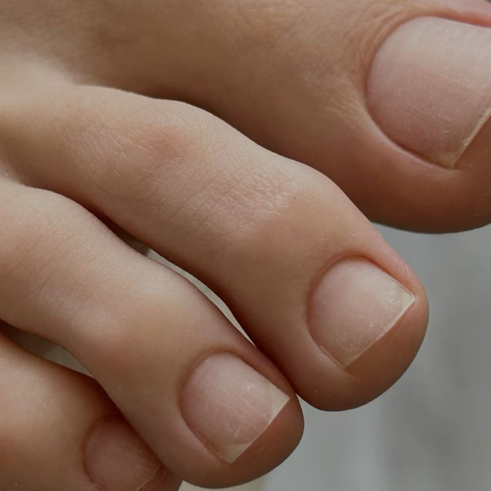 Гигиенический педикюр( только пальчики) без покрытия