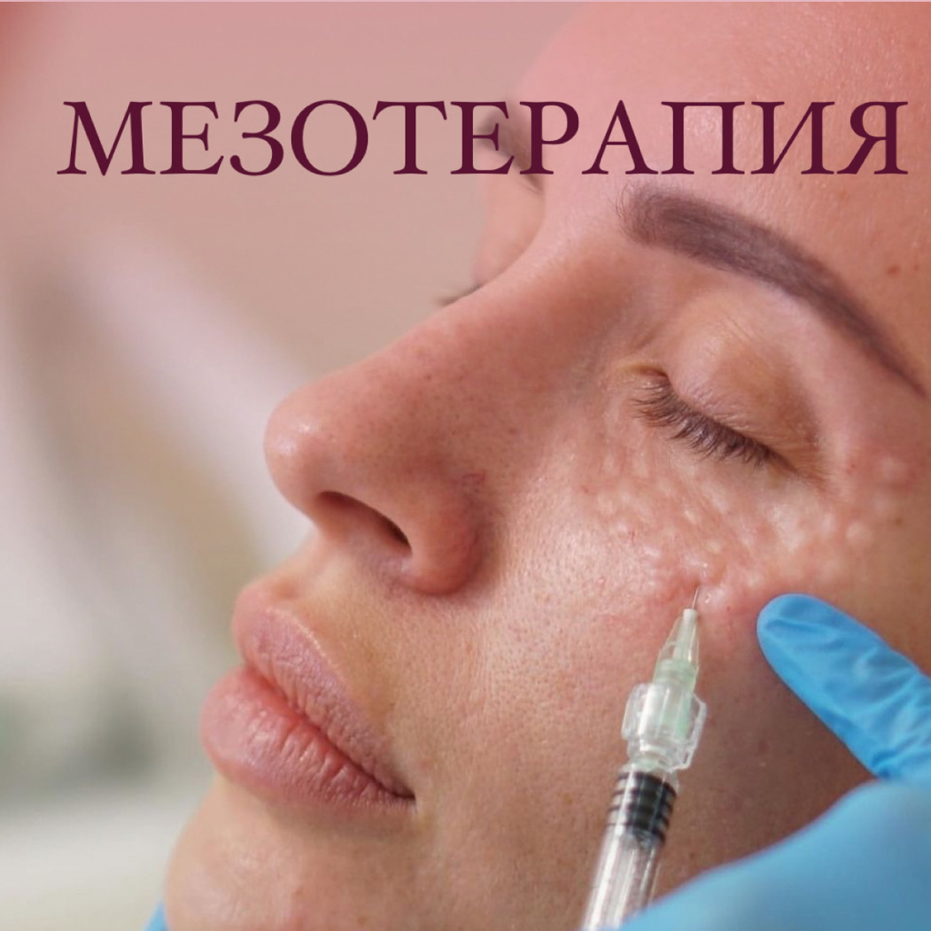 Мезотерапия