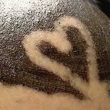 Осветление/Чистка ПОДМЫШЕЧНЫХ ВПАДИН