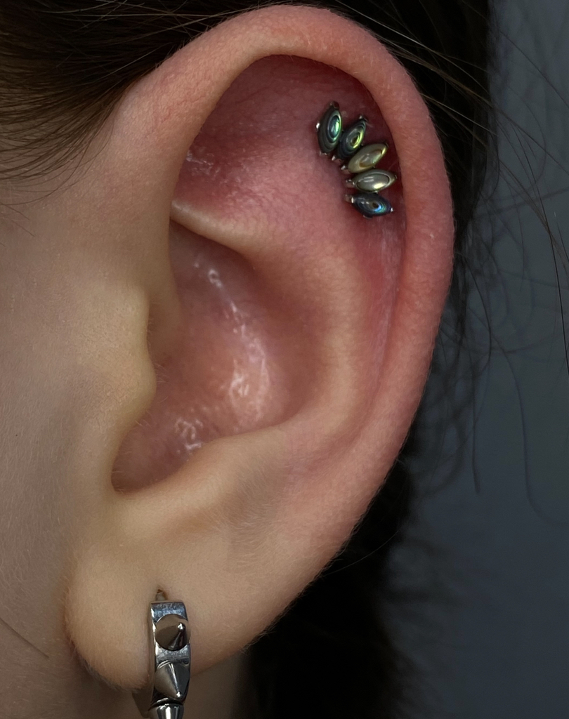 Восстановление канала