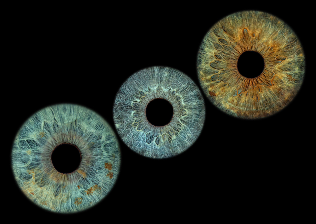 Zdjęcie z 3 tęczówkami lub więcej | A photo with 3 irises or more