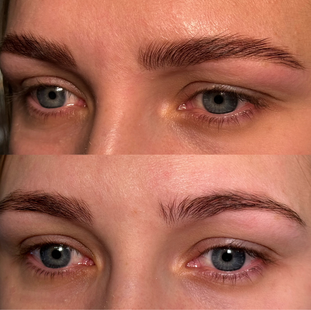 Депиляция 1 зона (усики или подбородок) 🤗