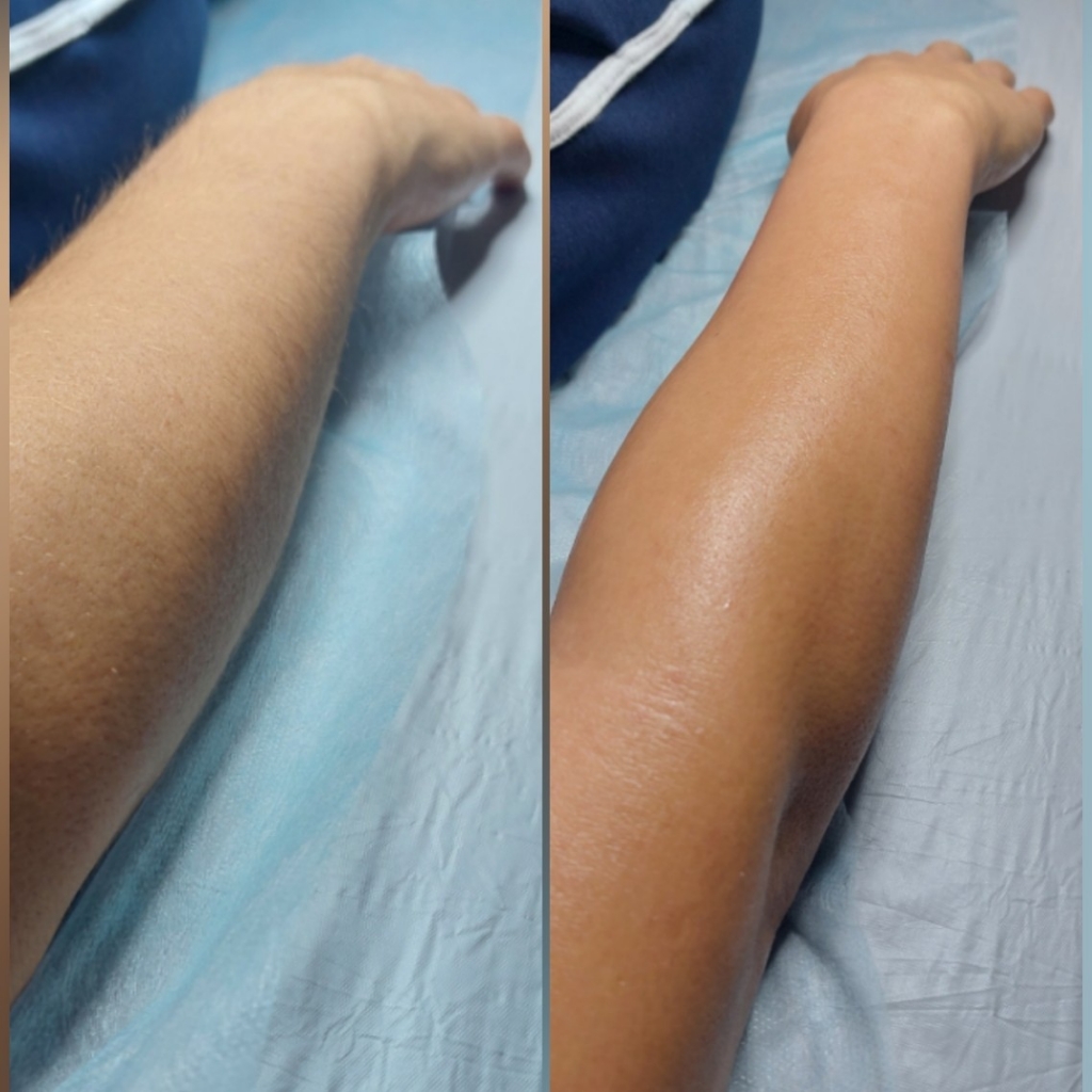 Руки до локтя