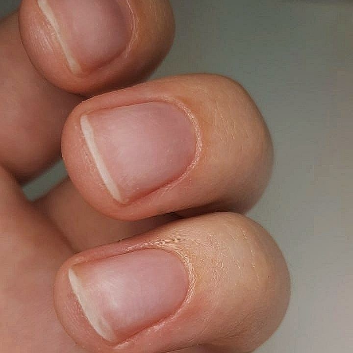 Снятие покрытия