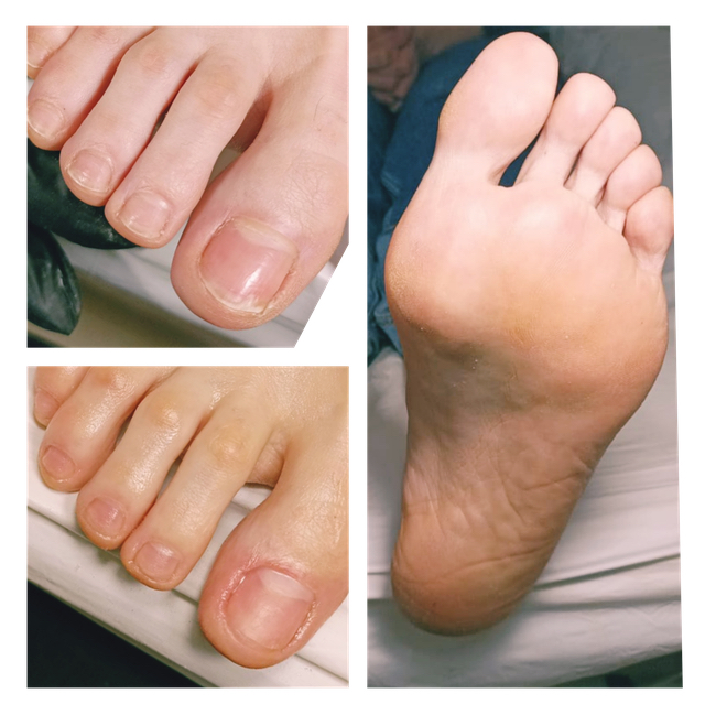 Pédicure - Beauté des pieds sans vernis | Педикюр без покрытия