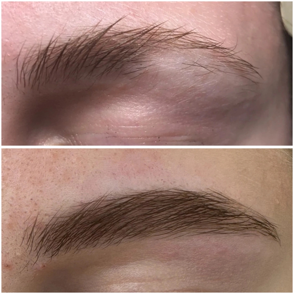 Консультация по восстановлению бровей и домашнему уходу