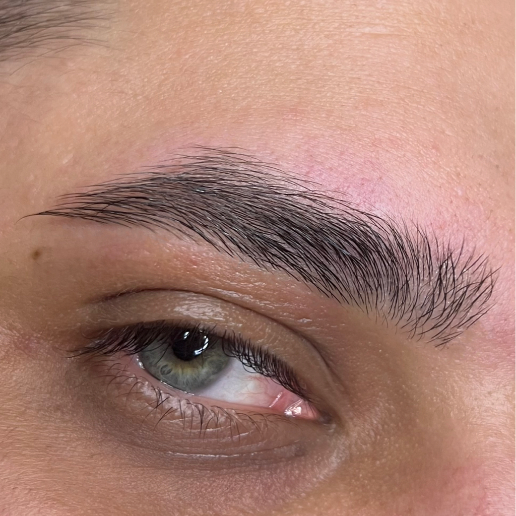 Коррекция пинцетом и/или воском