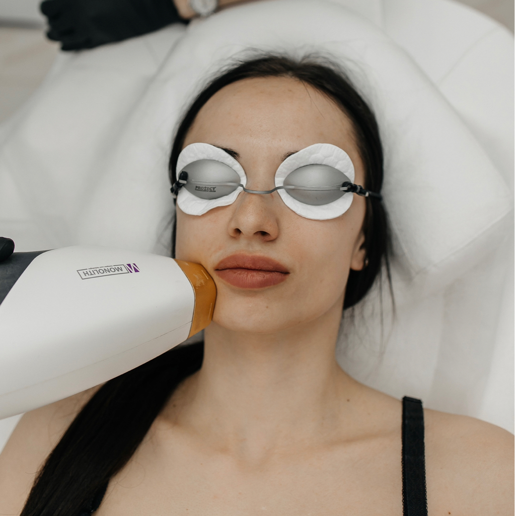 Лазерное омоложение лица