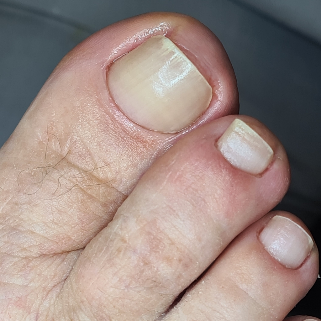 Педикюр гигиенический