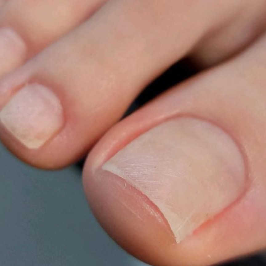 Smart-педикюр , гигиенический педикюр без покрытия