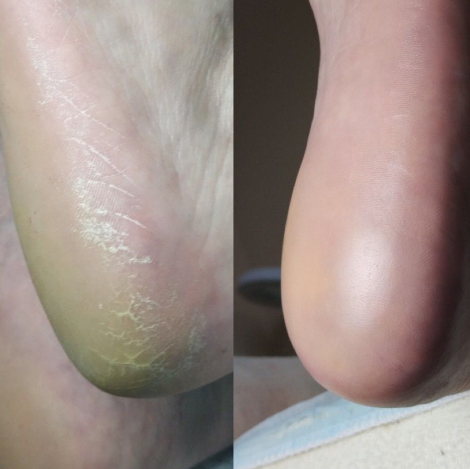 Обработка пяток ( женские )