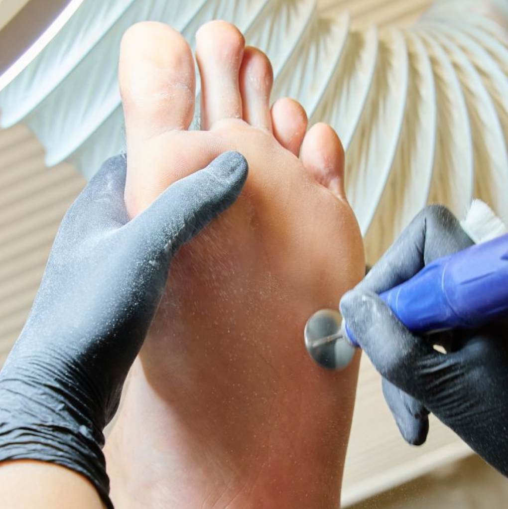 Мужской smart-педикюр, гигиенический педикюр