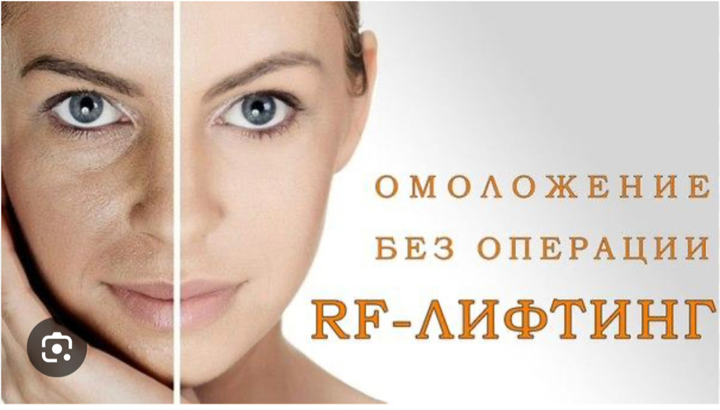 RF лифтинг лица