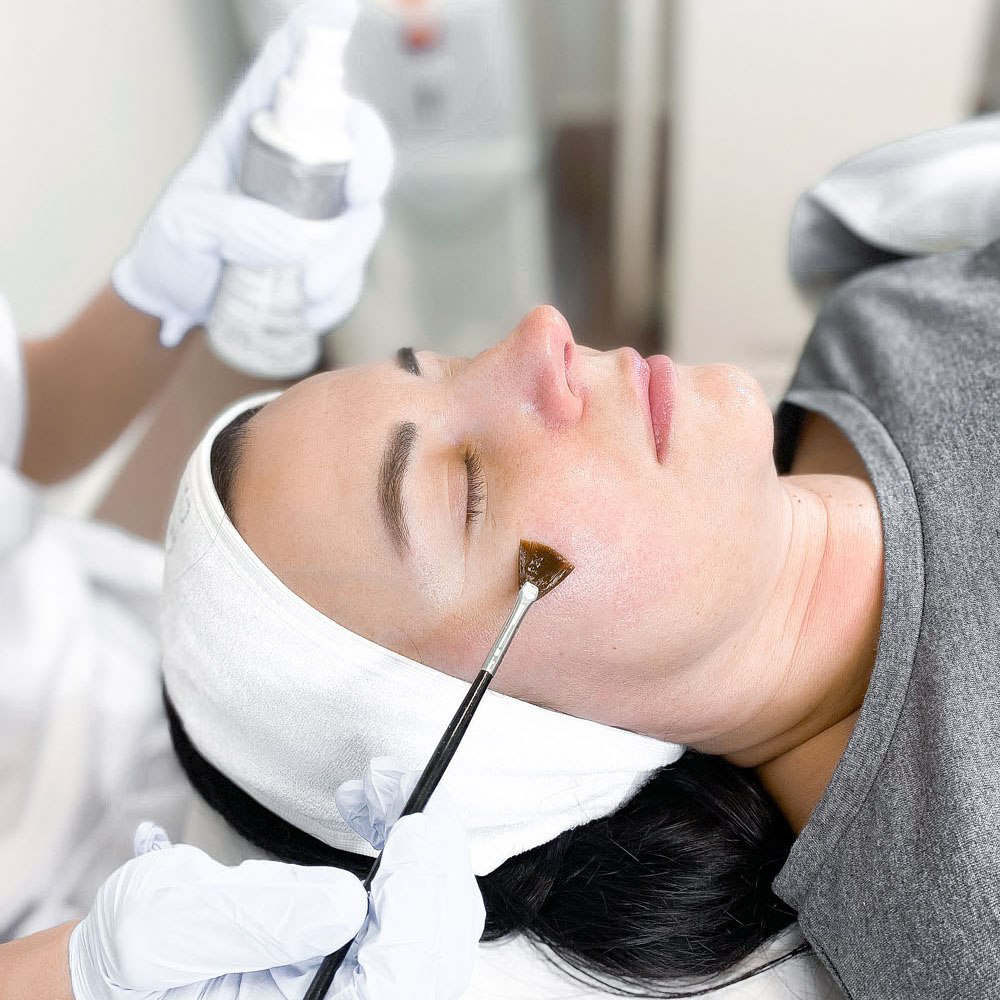 Карбокситерапия