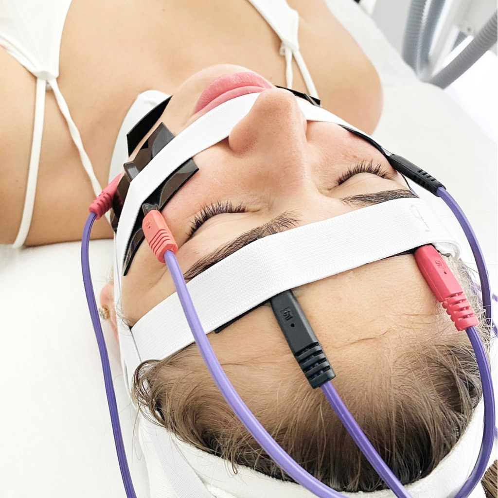 Миостмуляция лица