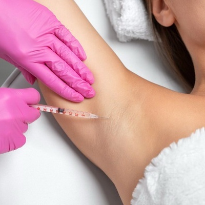 Лечение гипергидроза