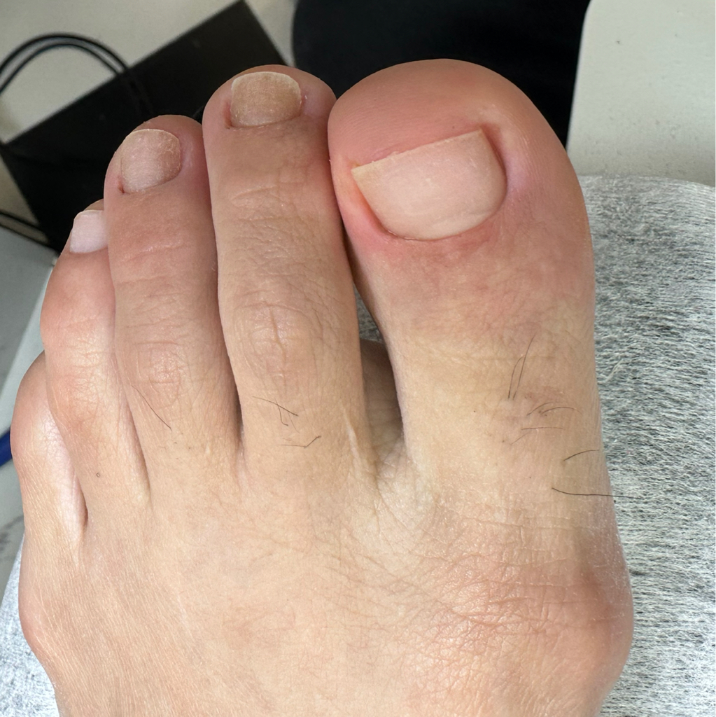 Дисковой педикюр без покрытия