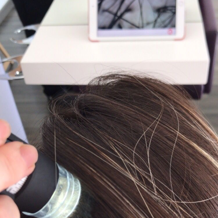 Трихологический комплекс MINI