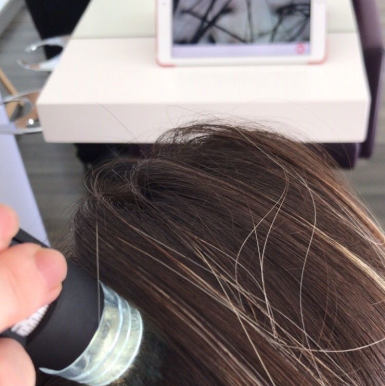 Трихологический комплекс MAX