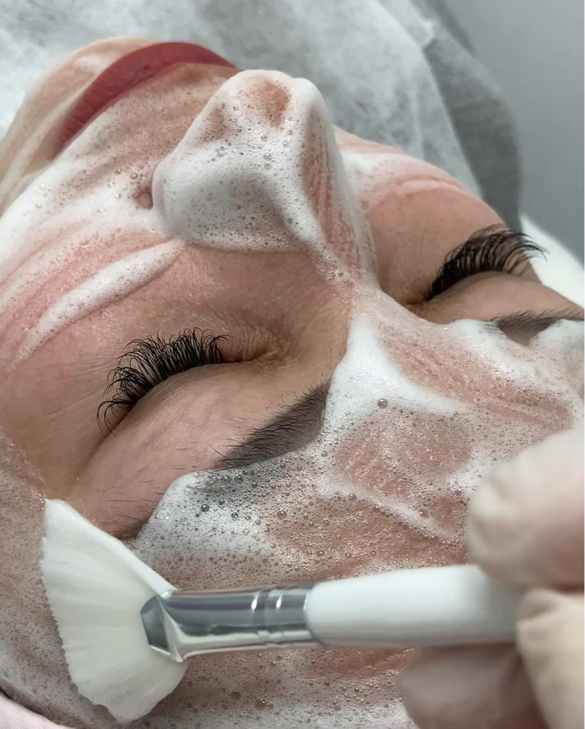 ONmacabim + Alpika. Карбокситерапия неинвазивная и уход