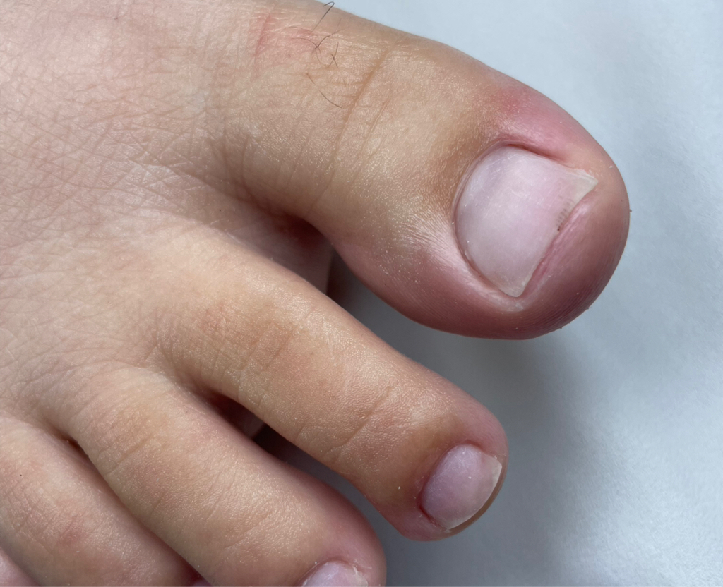 педикюр пальчики ( Без покрытия гель -лак)