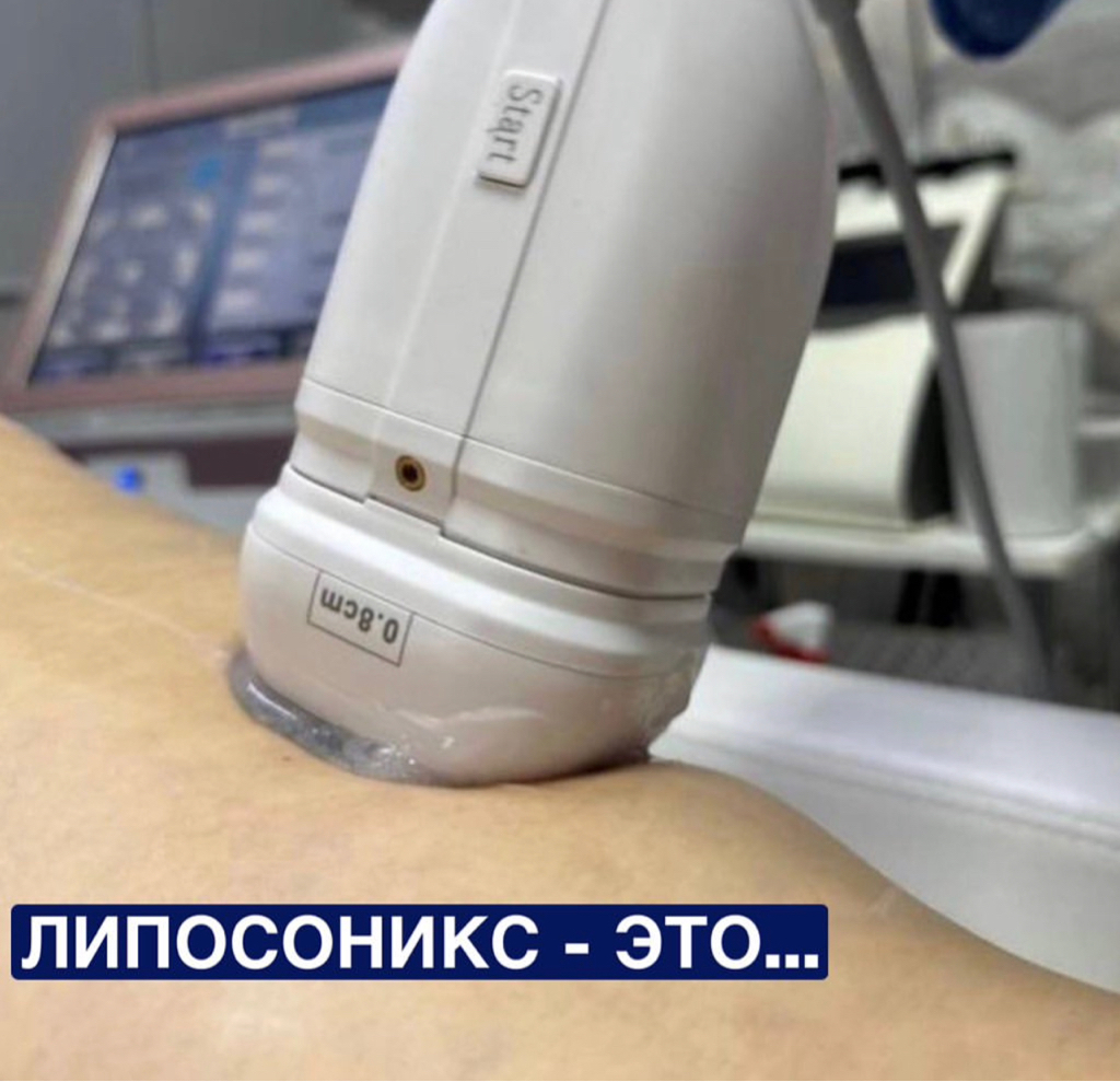 Липосоникс