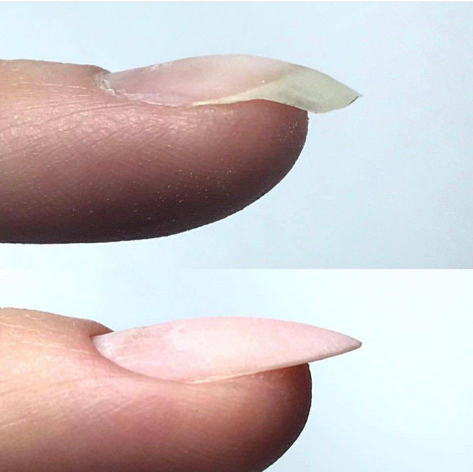 Ремонт ногтя