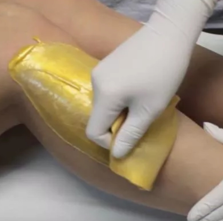 Голени или бедра (полимерная депиляция)