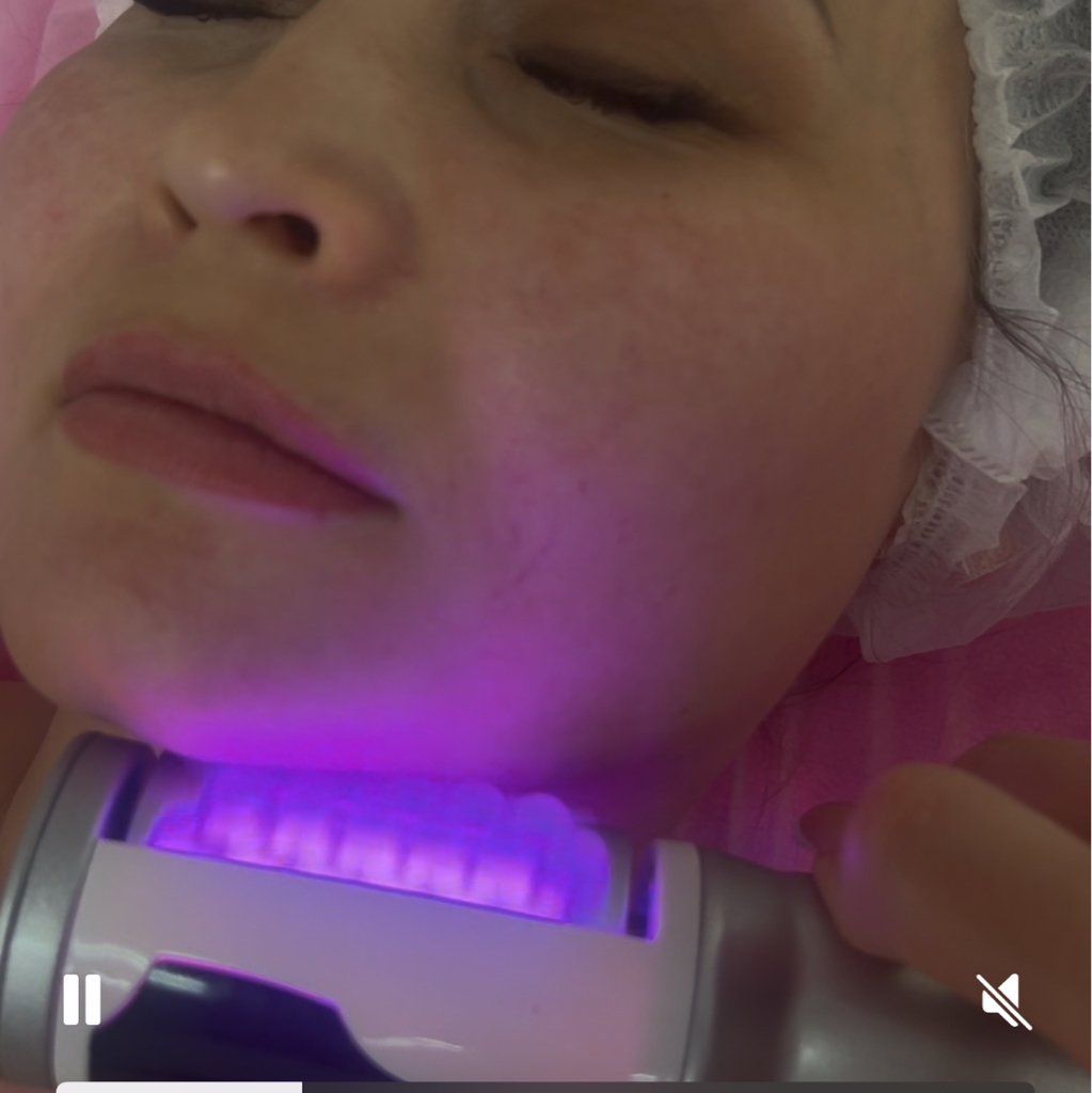 Виброкомпрессионный роликовый массаж лица и зона декольте