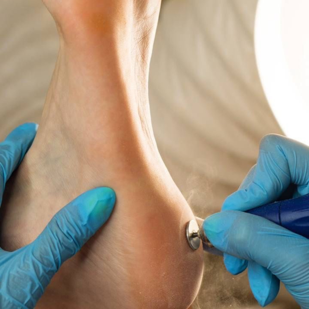 Мужской педикюр