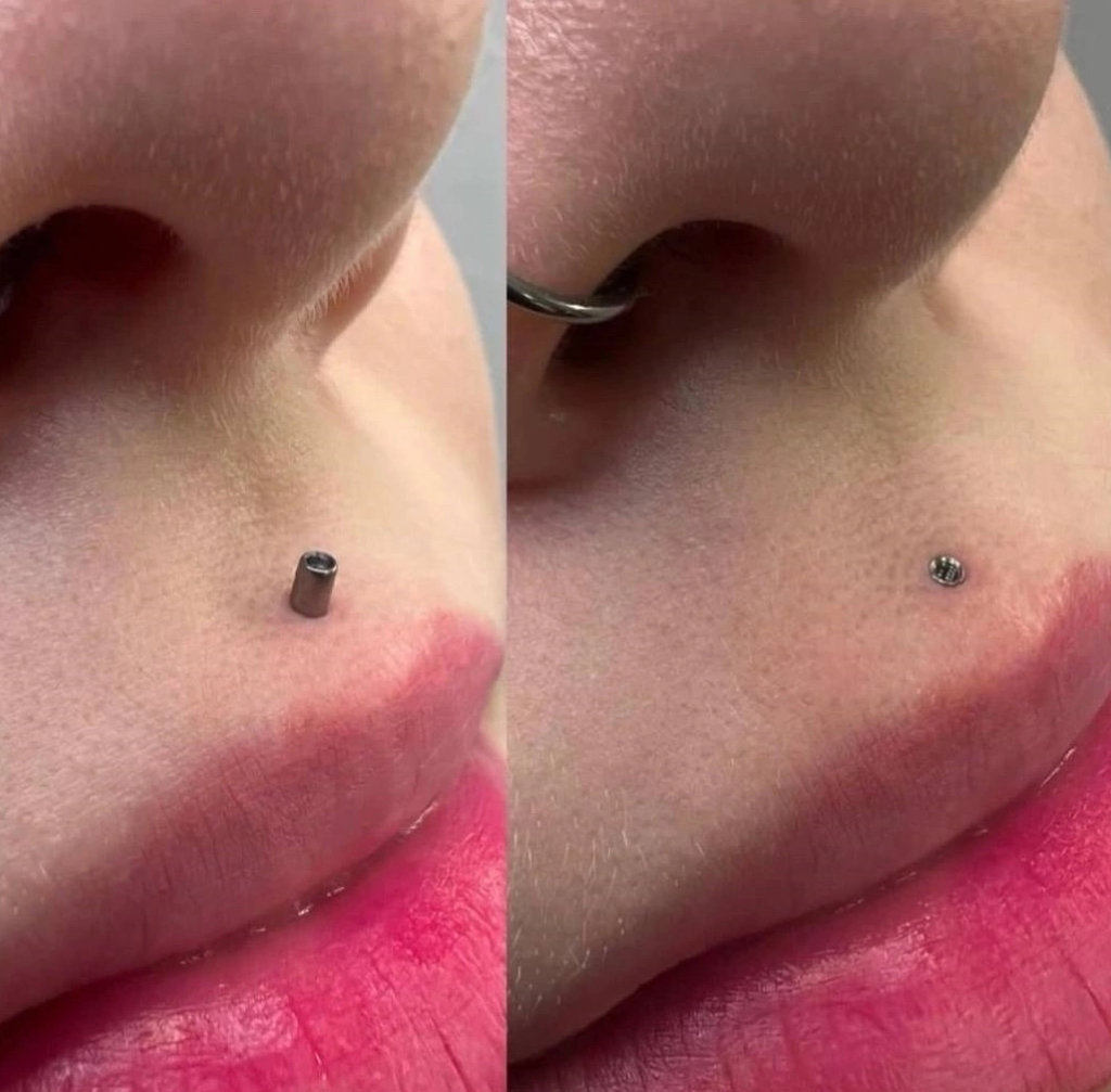 Даунсайз / апсайз (замена украшения)