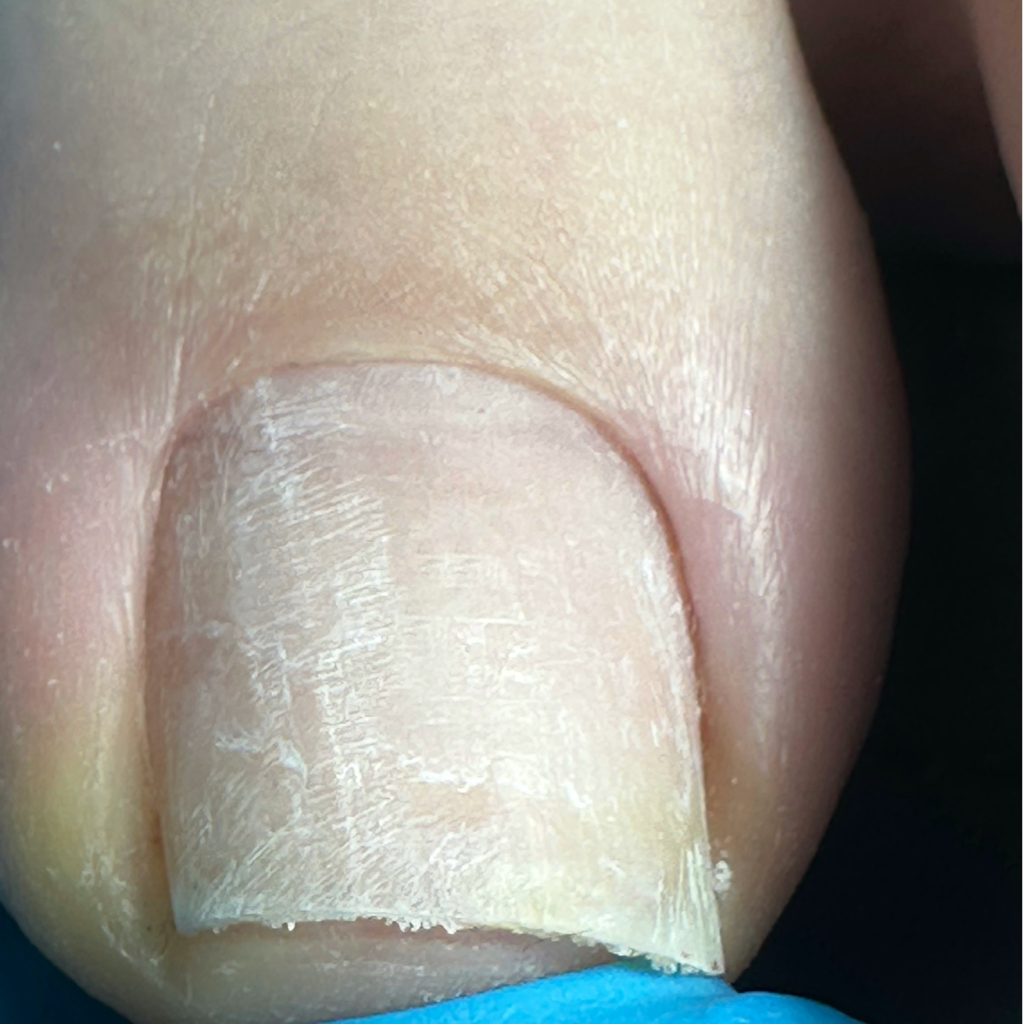 Комбинированный педикюр(обработка пальчиков)