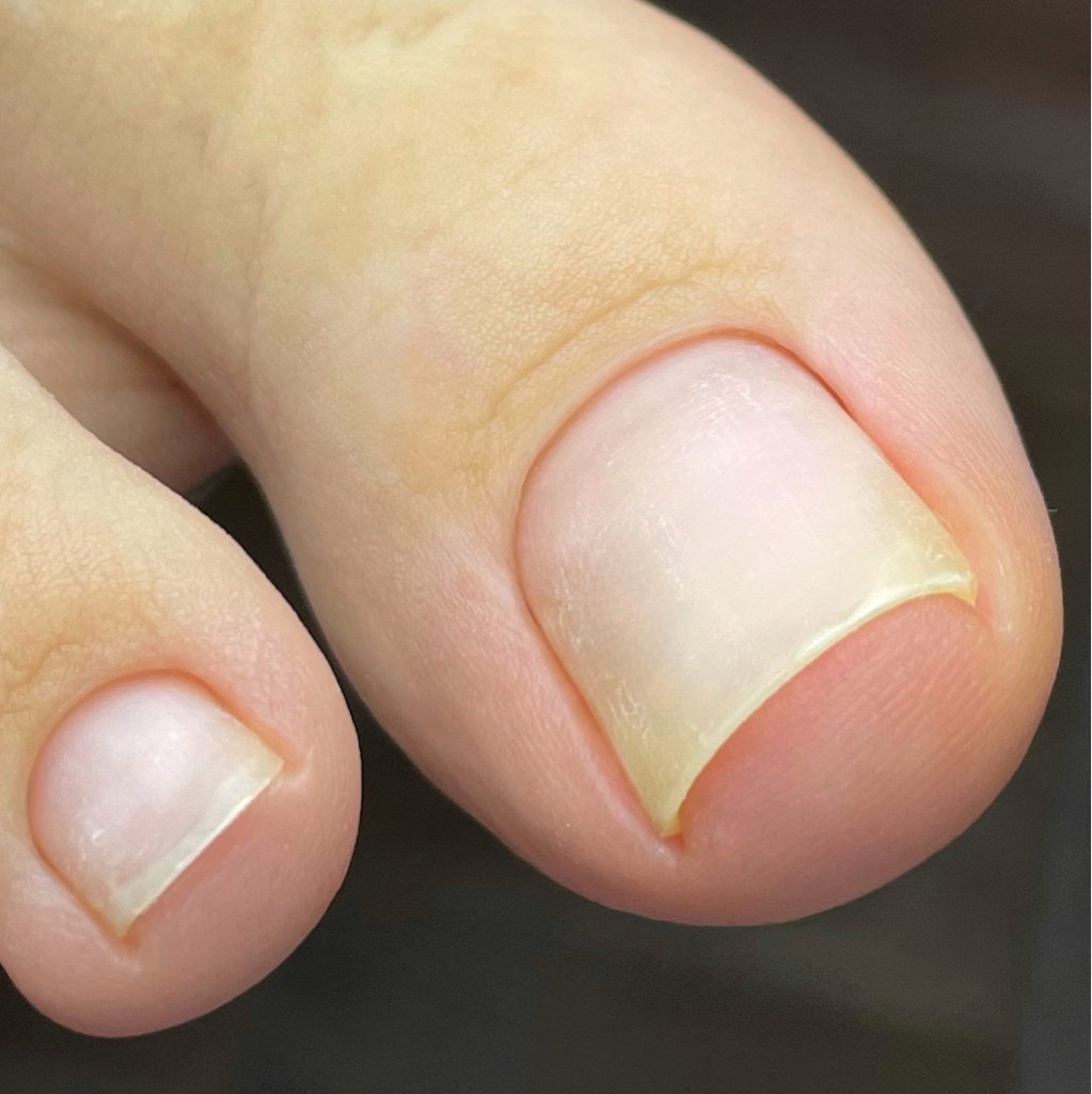 Педикюр MINI (обработка пальцев ног)