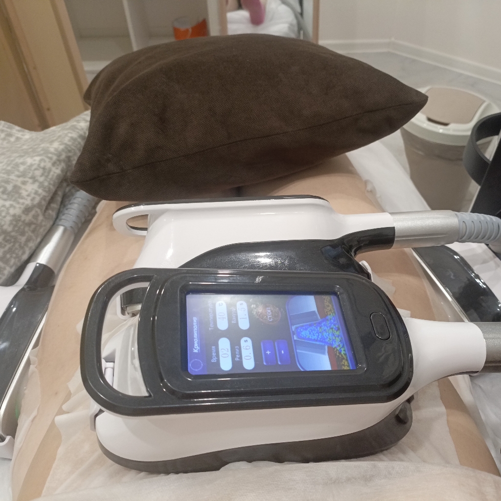 Криолиполиз (4 зоны)