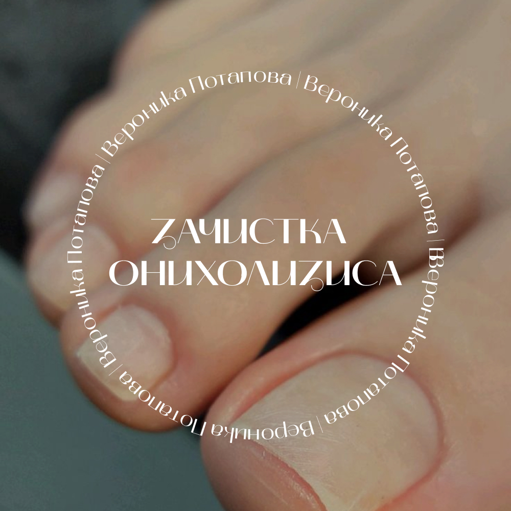 Зачистка онихолизиса