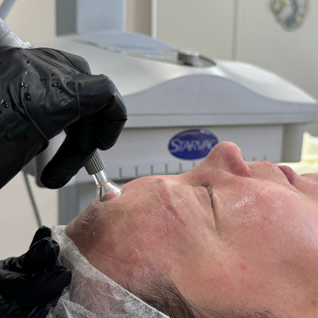 Массаж лица STARVAK