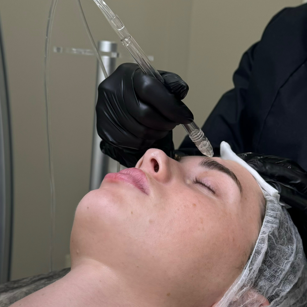 Jet peel + Starvac лицо