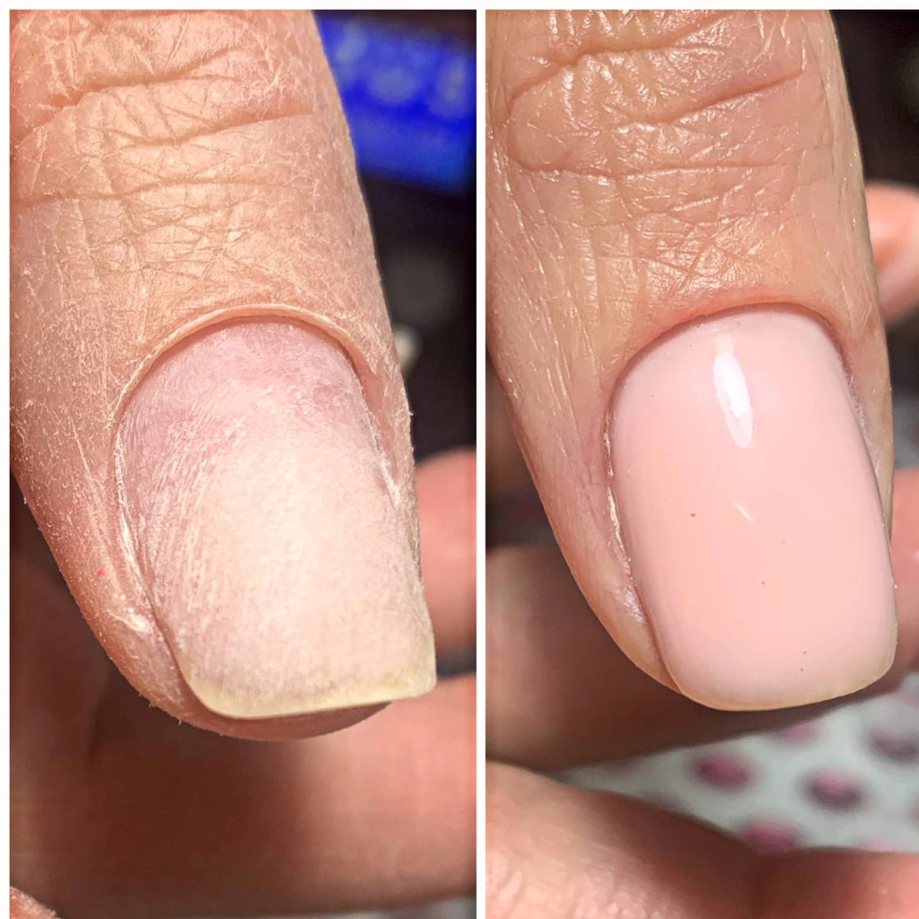 Ремонт ногтя