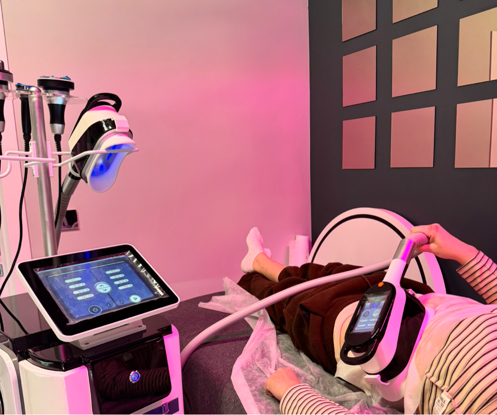 Криолиполиз