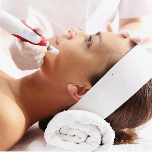 Фракционная мезотерапия(Микронидлинг)