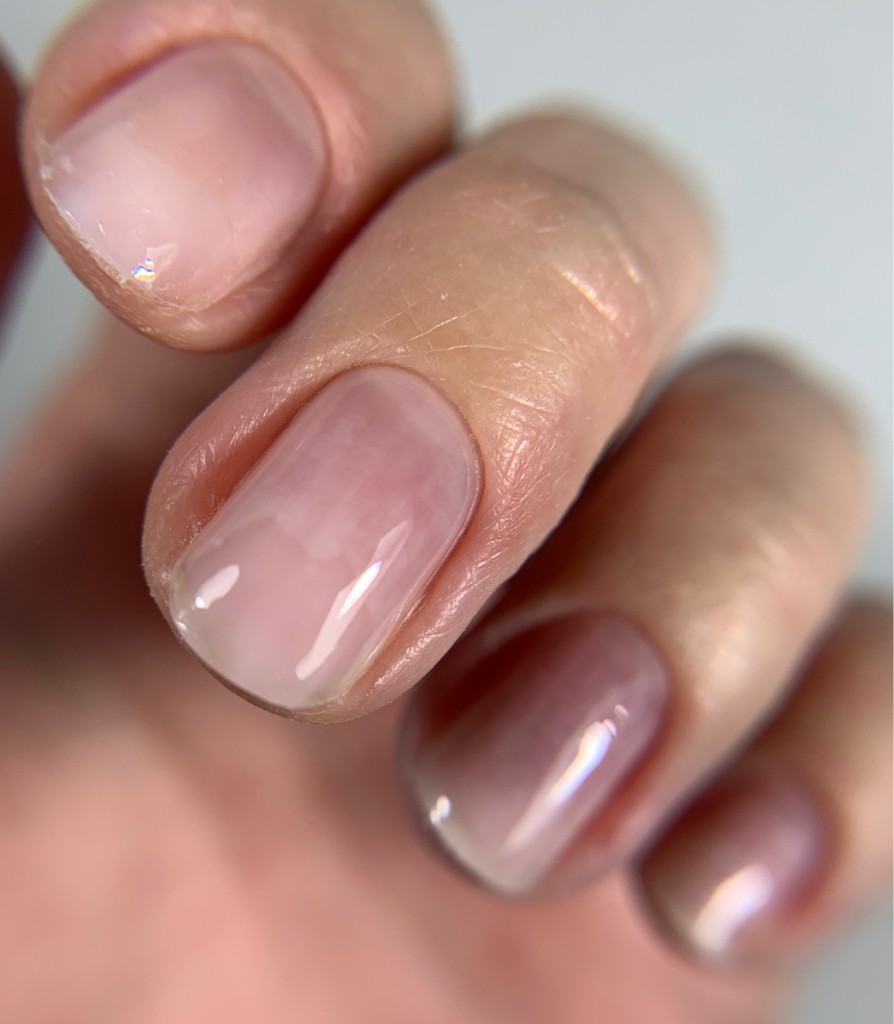 Damaged nail restoration