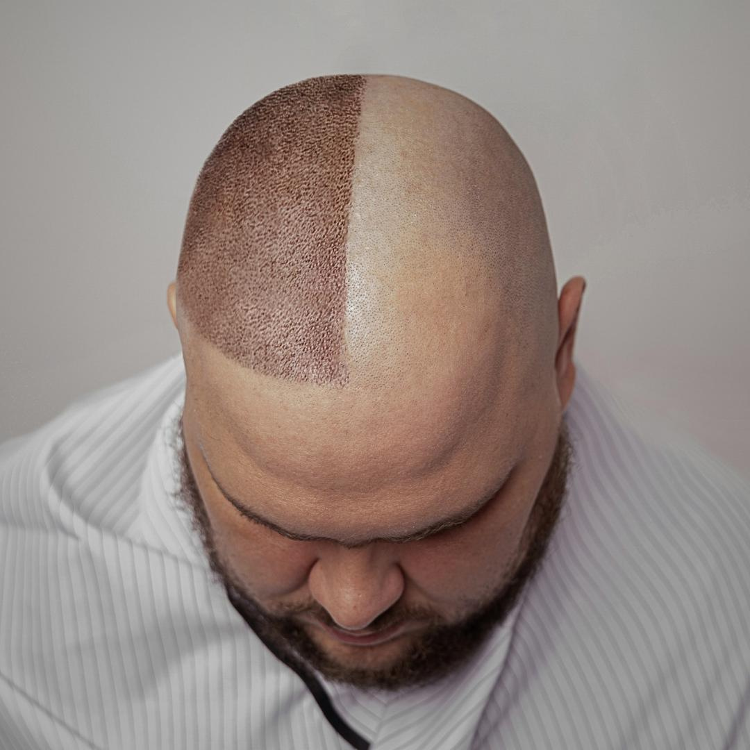 Стрижка наголо