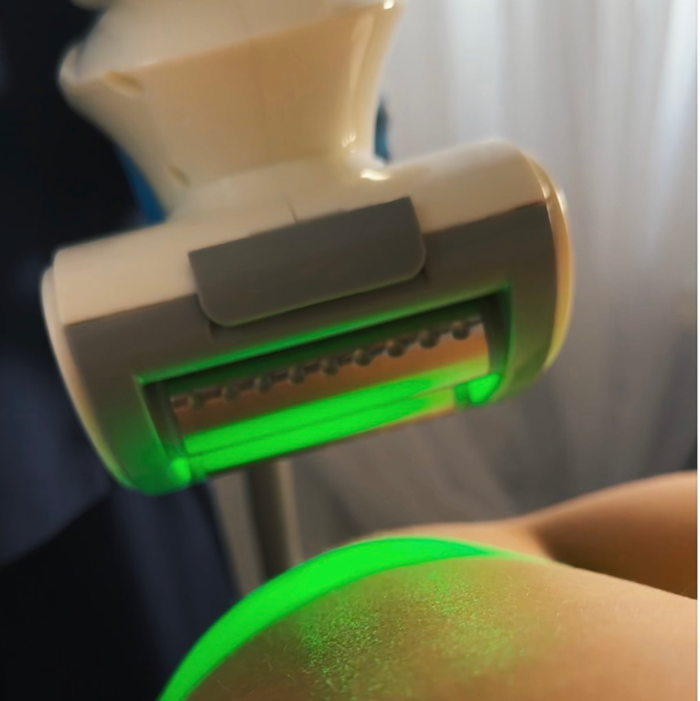 Абонемент  5 сеансов VelaShape + 5 сеансов вибромассажа 14.000